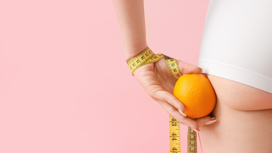 Celulitis: qué es, por qué aparece y cómo mejorar su aspecto de forma natural