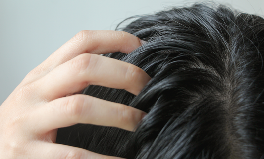 Por qué tu pelo se engrasa rápido y cómo solucionarlo sin químicos