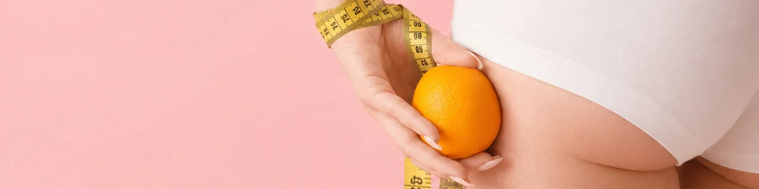 Celulitis: qué es, por qué aparece y cómo mejorar su aspecto de forma natural